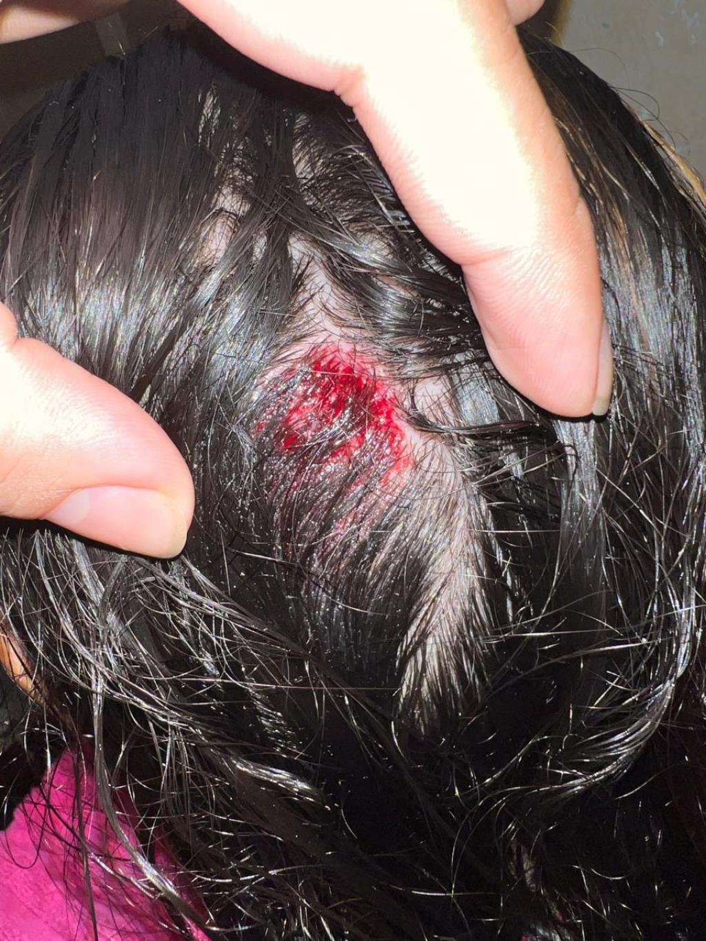 Universitaria entregó sus pertenencias en un atraco y aún así el ladrón le disparó en la cabeza dejándola gravemente herida