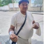 ¿Y ahora quién le hará los bollos? hombre no podrá trabajar por un buen tiempo tras ser atacado por un perro Pitbull