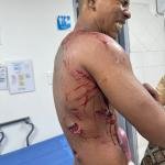 Hombre resulta gravemente atacado por caimán en un río de la Sierra Nevada de Santa Marta