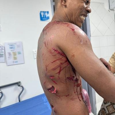 Hombre resulta gravemente atacado por caimán en un río de la Sierra Nevada de Santa Marta