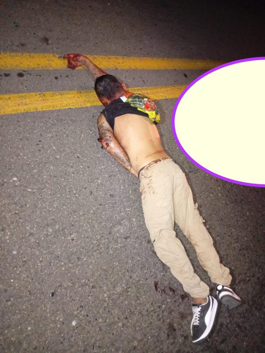 Le cercenaron los dedos y lo atacaron a puñal: el hombre que salió hasta la carretera a pedir ayuda en Santa Marta para que no lo asesinaran