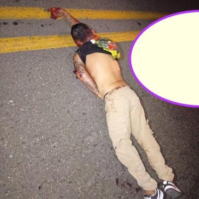 Le cercenaron los dedos y lo atacaron a puñal: el hombre que salió hasta la carretera a pedir ayuda en Santa Marta para que no lo asesinaran