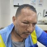 Trabajador de Aire quedó con heridas luego de ser atacado a golpes cuando se disponía a cortar el servicio de energía